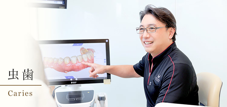 札幌市中央区で「痛くない」虫歯治療｜千葉歯科クリニック